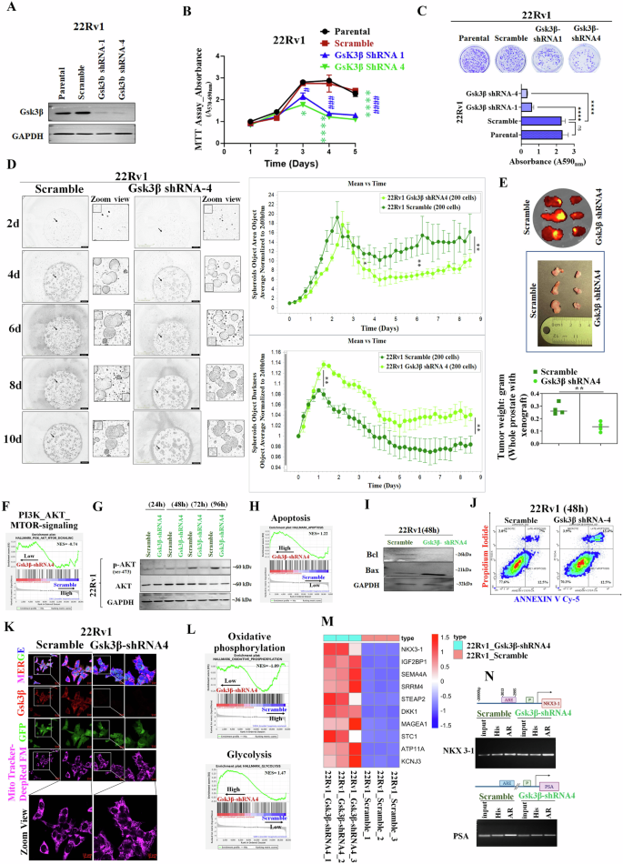 Fig. 5: Knocking down of Gsk3β triggers an anti-proliferative response in CRPC Cells.