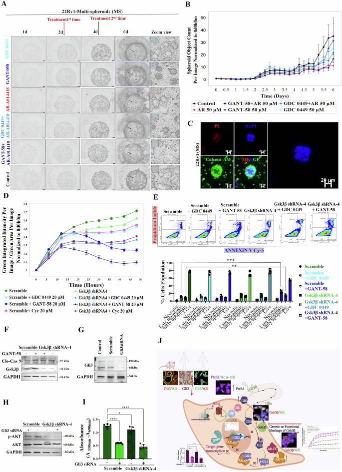 Fig. 7: Cytotoxic effects of concurrent Gsk3β inhibition with either Smo or Gli1 or solely Gli3 inhibition.
