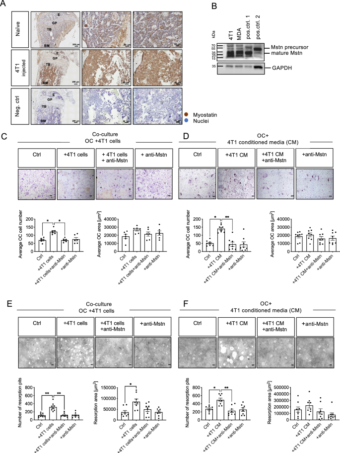 Fig. 2: Enhanced OC differentiation and bone resorption by 4T1 BC-cell OC interaction is mediated by Mstn in vitro.