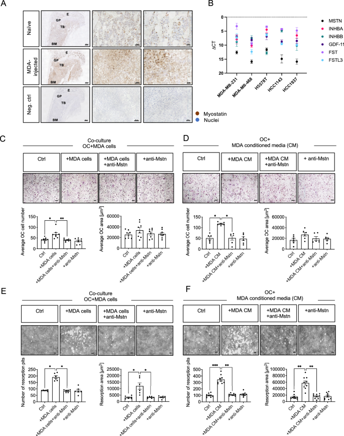 Fig. 3: Enhanced OC differentiation and bone resorption by MDA BC-cell OC interaction is mediated by Mstn in vitro.