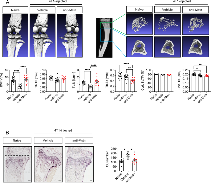 Fig. 5: Anti-Mstn treatment effectively reduces bone lesions and OC formation in a syngeneic 4T1 mouse model of BC metastases.