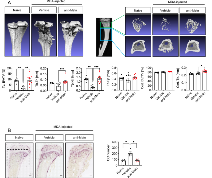 Fig. 7: Anti-Mstn treatment effectively reduces bone lesions and OC formation in a xenograft MDA mouse model of BC metastases.