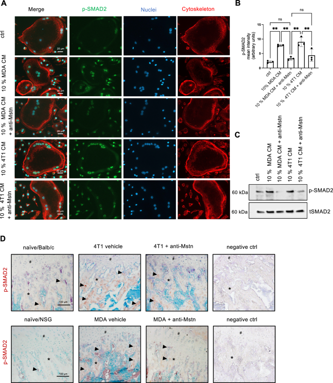 Fig. 8: Anti-Mstn treatment reduces tumor-cell mediated SMAD2 phosphorylation in osteoclasts.