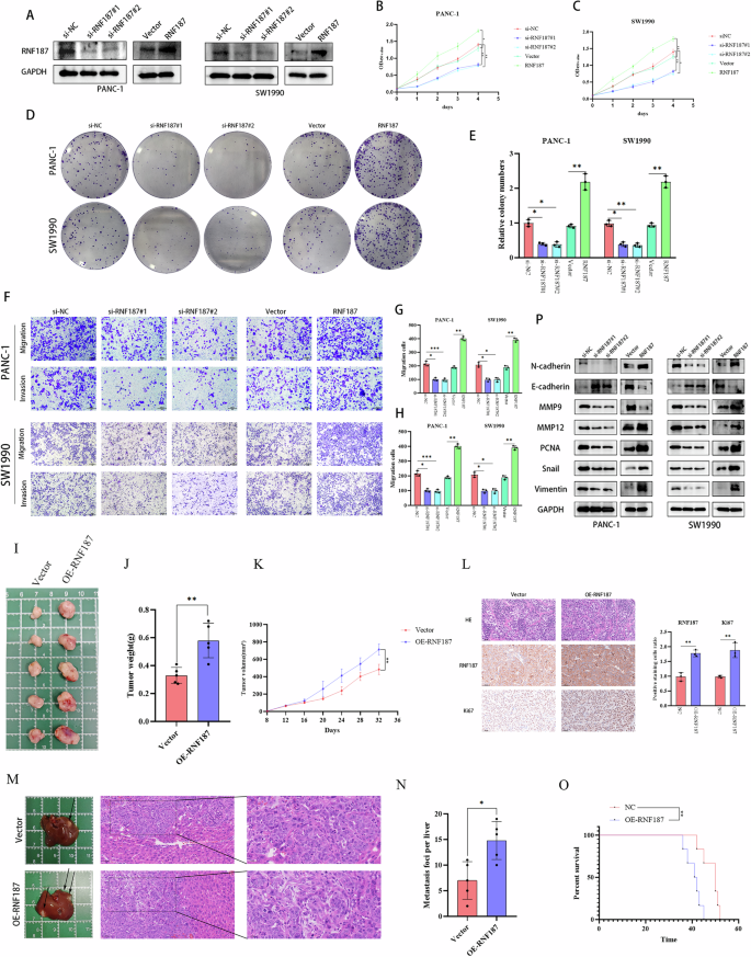 Fig. 2: RNF187 promotes the malignant phenotype of pancreatic cancer cells.