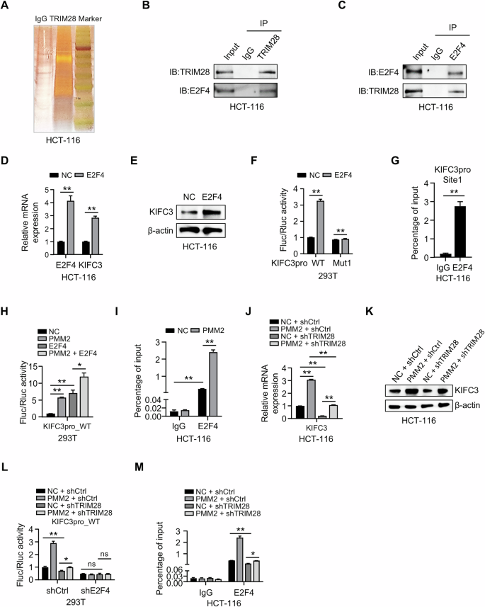 Fig. 5: E2F4 mediates PMM2/TRIM28-regulated KIFC3 transcription.