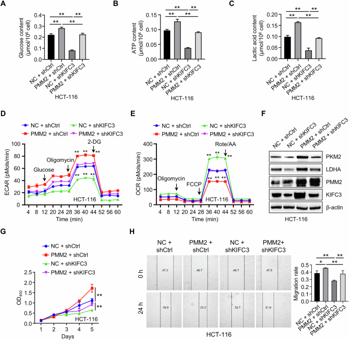 Fig. 6: KIFC3 mediates PMM2-driven glycolysis and CRC progression.