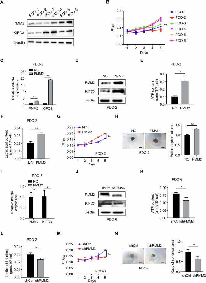 Fig. 8: PMM2 regulates glycolysis and tumorigenicity in CRC PDOs.