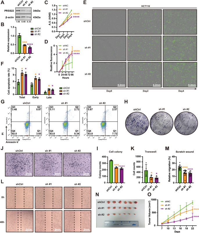 Fig. 2: Knocking down PRSS22 inhibits growth and survival of CRC cells.