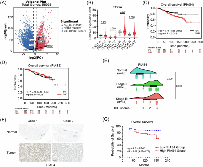 Fig. 1: PIAS4 exhibits high expression levels in breast cancer and is inversely associated with prognosis.