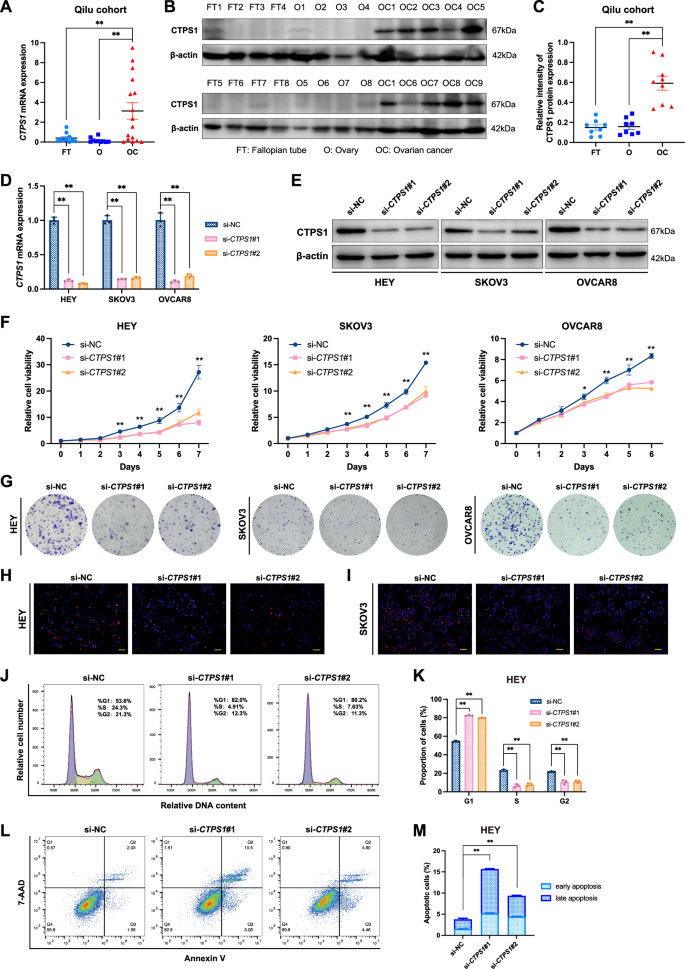 Fig. 5: CTPS1 expression is elevated in OC, and CTPS1 knockdown inhibits the malignant phenotypes of OC cells.