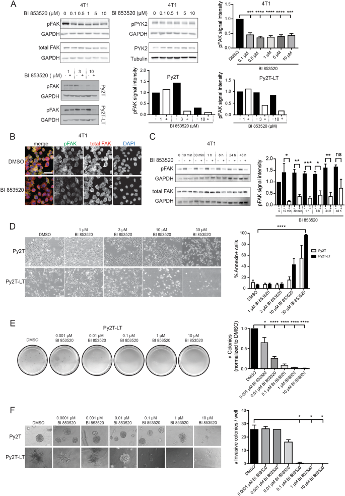 The FAK inhibitor BI 853520 exerts anti-tumor effects in breast cancer |  Oncogenesis