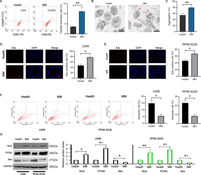 Activated platelet-derived exosomal LRG1 promotes multiple myeloma cell growth