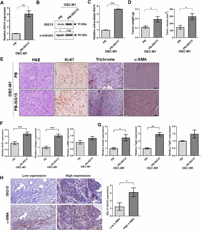 Tumor cell-derived ISG15 promotes fibroblast recruitment in oral squamous cell carcinoma via CD11a-dependent glycolytic reprogramming