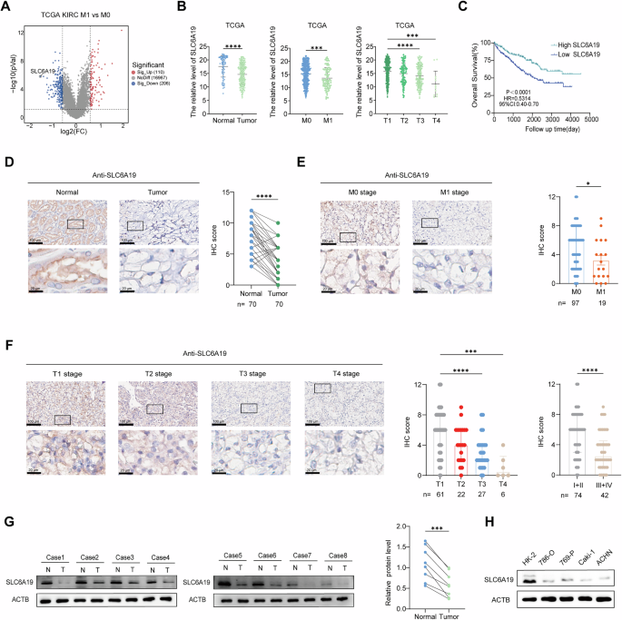 Fig. 1: Identify SLC6A19 as a candidate tumor suppressor gene in RCC.