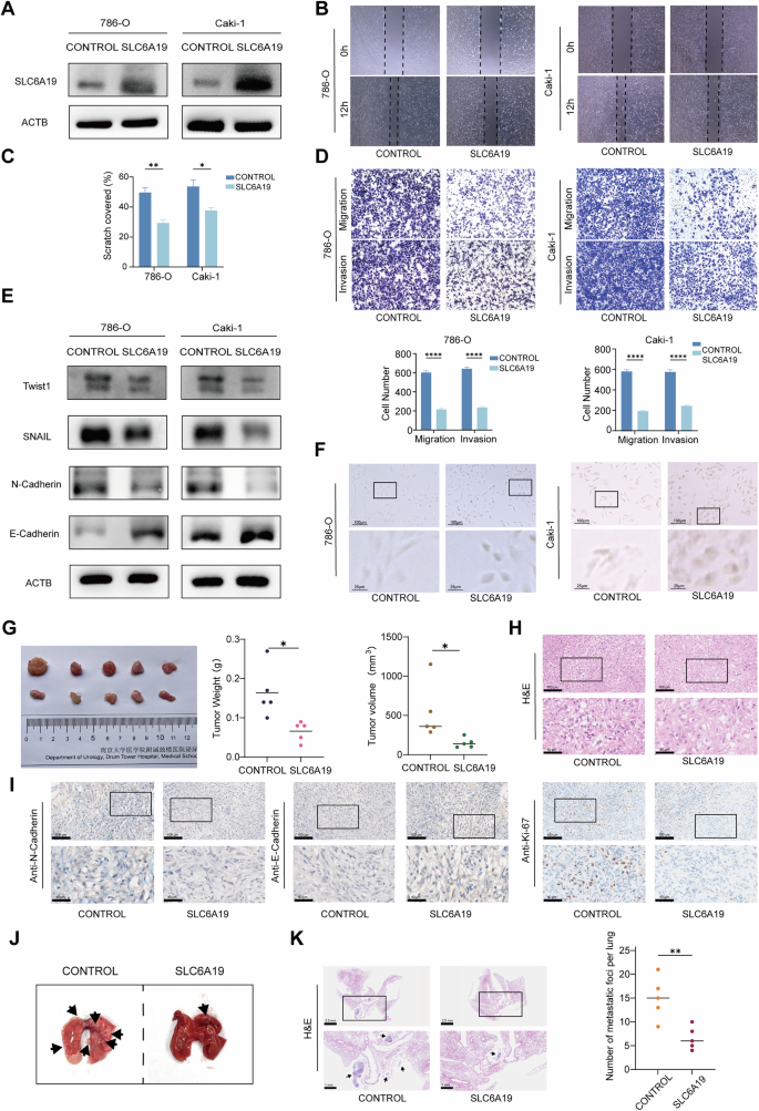 Fig. 2: SLC6A19 inhibits RCC metastasis in vitro and in vivo.