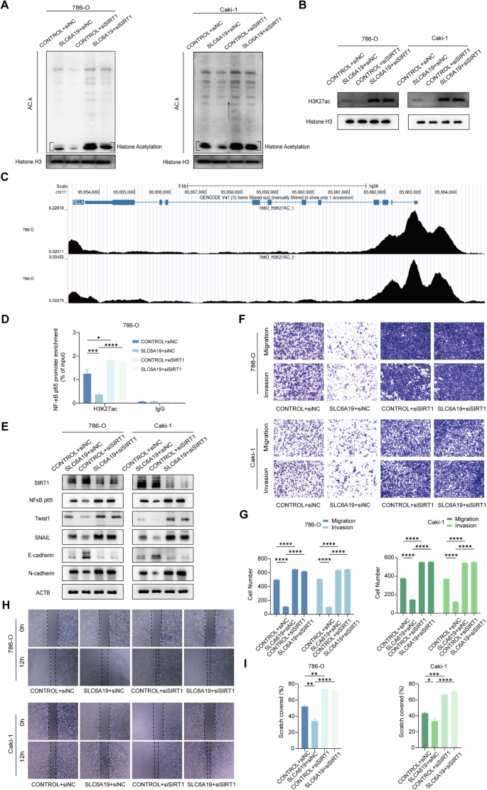 Fig. 5: NAD+-dependent SIRT1 downregulated NF-κB p65 expression via decaetylating histone H3.
