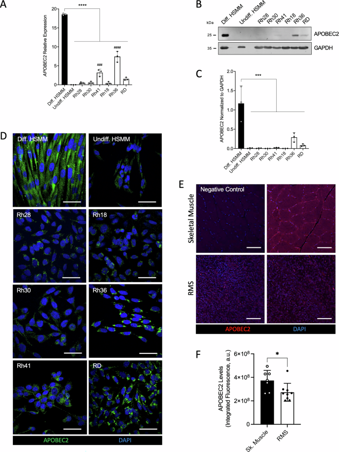 Fig. 1: Endogenous expression of APOBEC2 in patient-derived RMS cell lines and tumor specimens.
