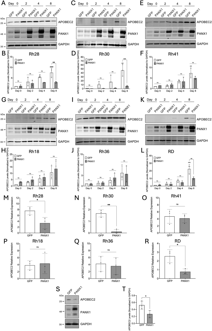 Fig. 2: APOBEC2 protein and transcript levels upon induction of PANX1 expression in RMS cells and xenografts.