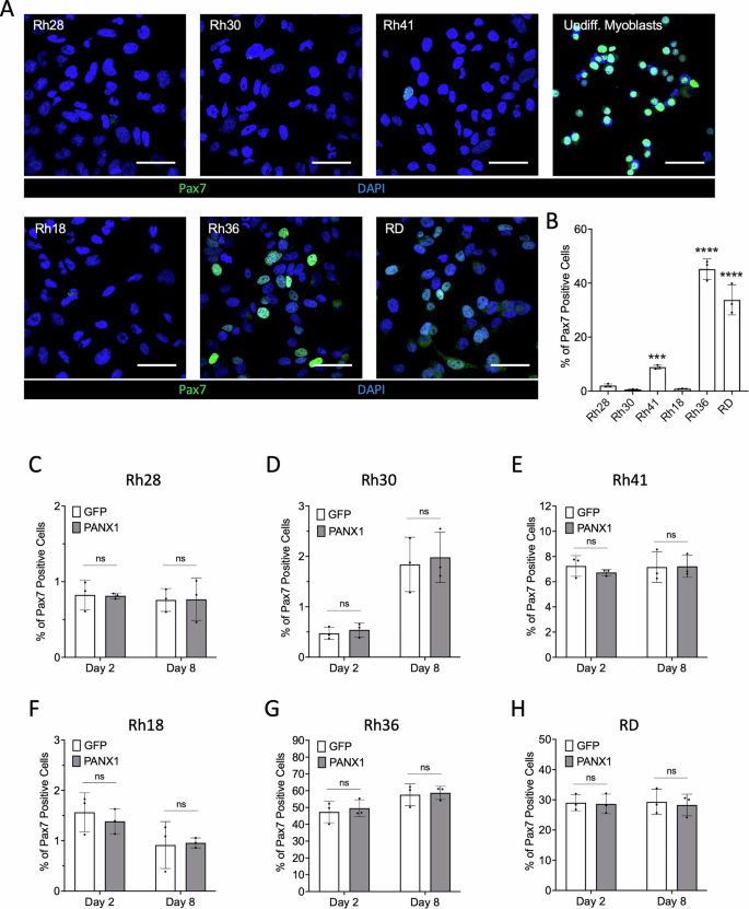 Fig. 3: Pax7 expression in wild-type RMS cell lines and following PANX1 overexpression.