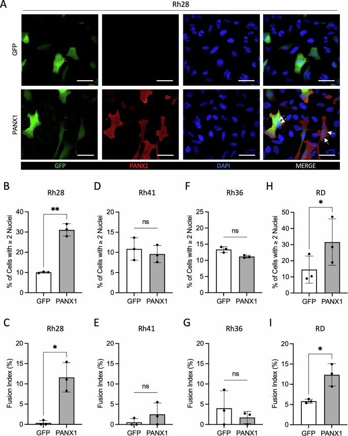 Fig. 4: Effect of PANX1 overexpression on multinucleation in the Rh28, Rh41, Rh36, and RD cell lines.
