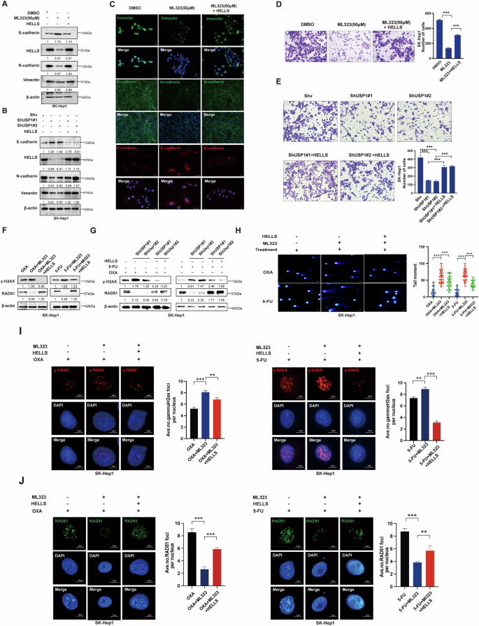 Fig. 6: USP1 induces EMT and chemotherapy-related HRR by modulating HELLS.