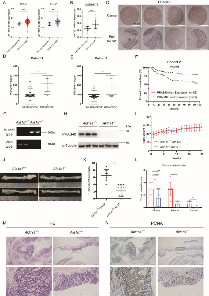 Fig. 1: Effects of PRAS40 on CRC formation.