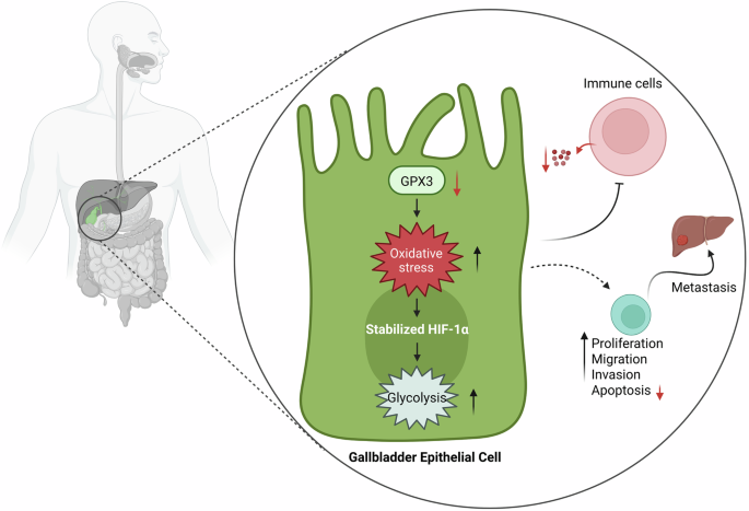 is it safe to take glutathione without gallbladder GPX3 suppresses gallbladder cancer progression by modulating redox balance,  glycolysis, and anti-tumor immunity