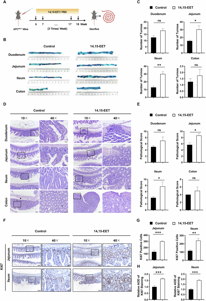 Fig. 3: 14, 15-EET promotes the progression of intestinal adenomas in ApcMin/+ mice.