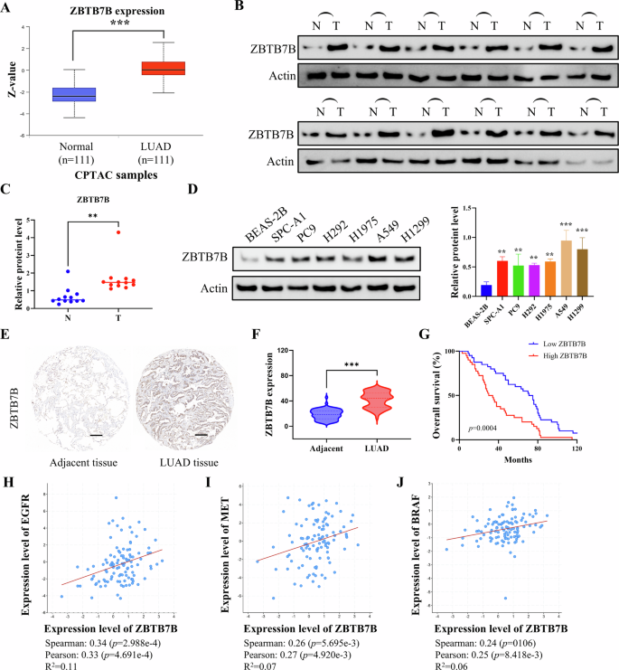 Fig. 1: ZBTB7B expression is elevated in LUAD and is associated with unfavorable prognosis and tumorigenesis.