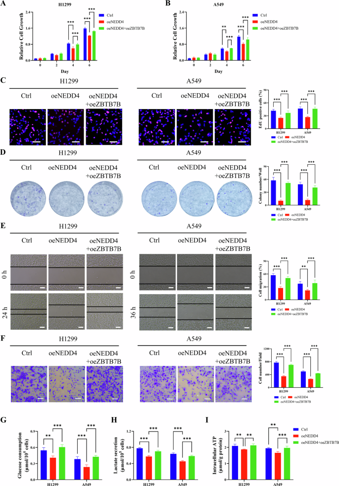 Fig. 7: NEDD4 suppresses lung cancer cell proliferation and glycolysis via promoting ZBTB7B degradation.