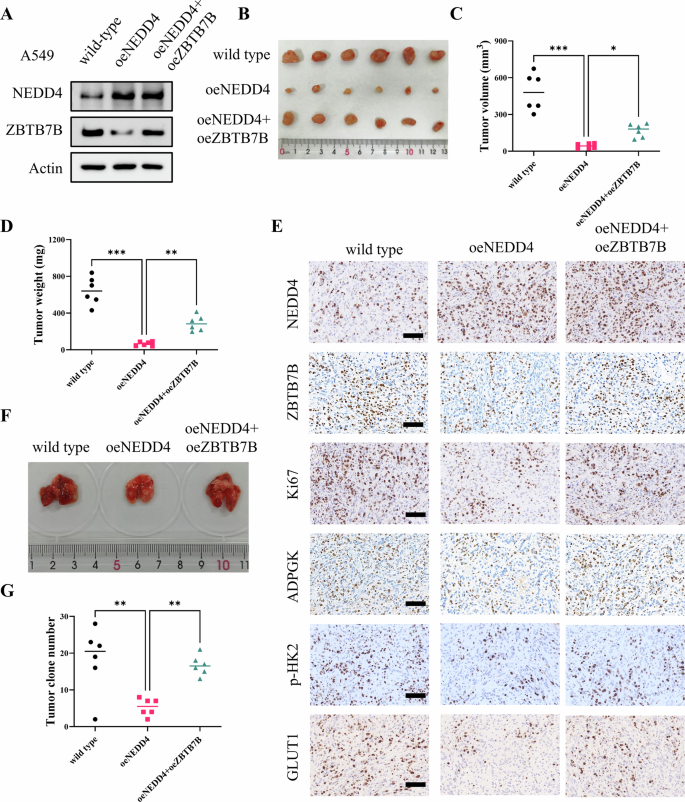 Fig. 8: NEDD4-mediated ZBTB7B degradation suppresses LUAD progression in vivo.