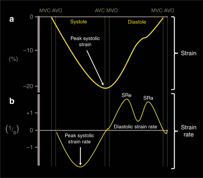 Speckle tracking derived strain in neonates: planes, layers and