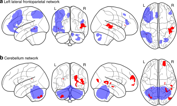 Functional brain connectivity in early adolescence after hypothermia-treated neonatal hypoxic-ischemic encephalopathy