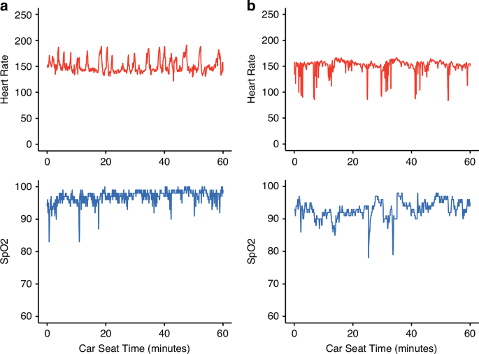 Car seat tolerance screen failure in the neonatal intensive care unit ...