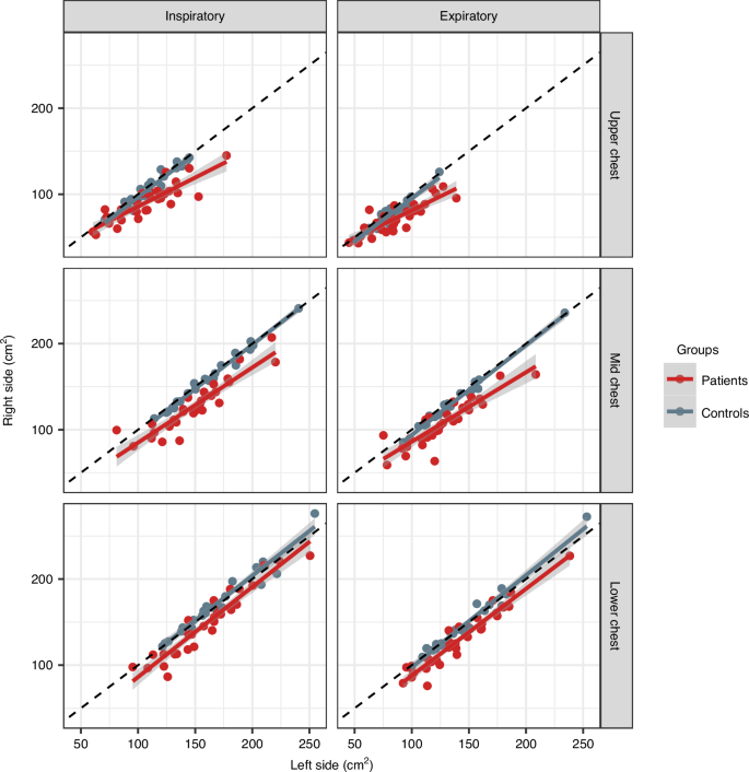 Fig. 2: Cross-sectional areas of the right hemithorax relative to the left in patients with esophageal atresia compared to healthy controls.