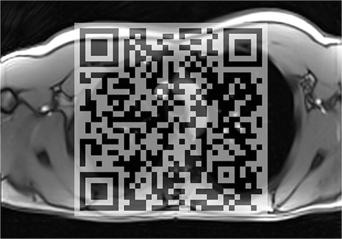 Fig. 4: Real-time MRI of a 24-year-old patient following neonatal repair of esophageal atresia.