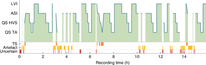 Fig. 1: Neonatal hypnogram with the different sleep states in the Y-as (ASI, LVI, QS-HVS, QS-TA) and relative time in the X-as.
