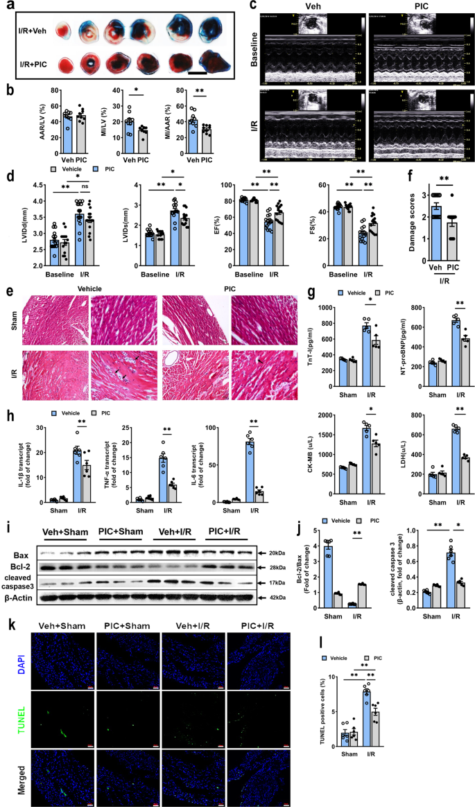 Poly(I:C) preconditioning protects the heart against myocardial  ischemia/reperfusion injury through TLR3/PI3K/Akt-dependent pathway |  Signal Transduction and Targeted Therapy