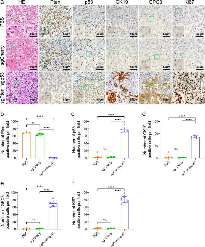Generation of in situ CRISPR-mediated primary and metastatic cancer from  monkey liver | Signal Transduction and Targeted Therapy