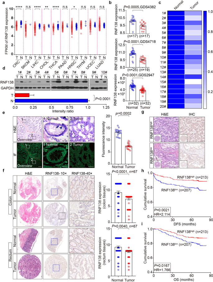 RING finger 138 deregulation distorts NF-кB signaling and facilities  colitis switch to aggressive malignancy | Signal Transduction and Targeted  Therapy