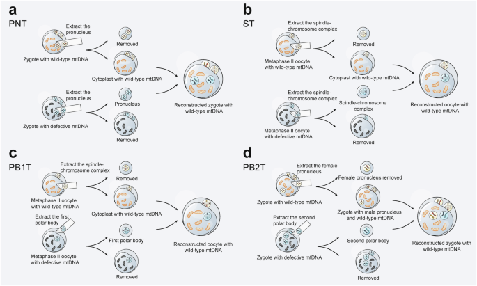 Mitochondrial diseases: from molecular mechanisms to therapeutic advances |  Signal Transduction and Targeted Therapy