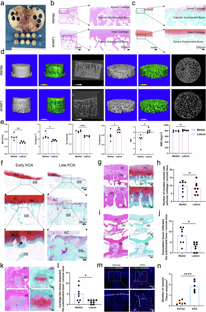 Single-cell transcriptomics reveals novel chondrocyte and osteoblast ...