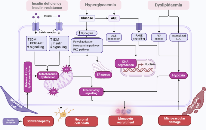 acetyl l carnitine diabetic neuropathy randomized controlled trial Diabetic neuropathy: cutting-edge research and future directions