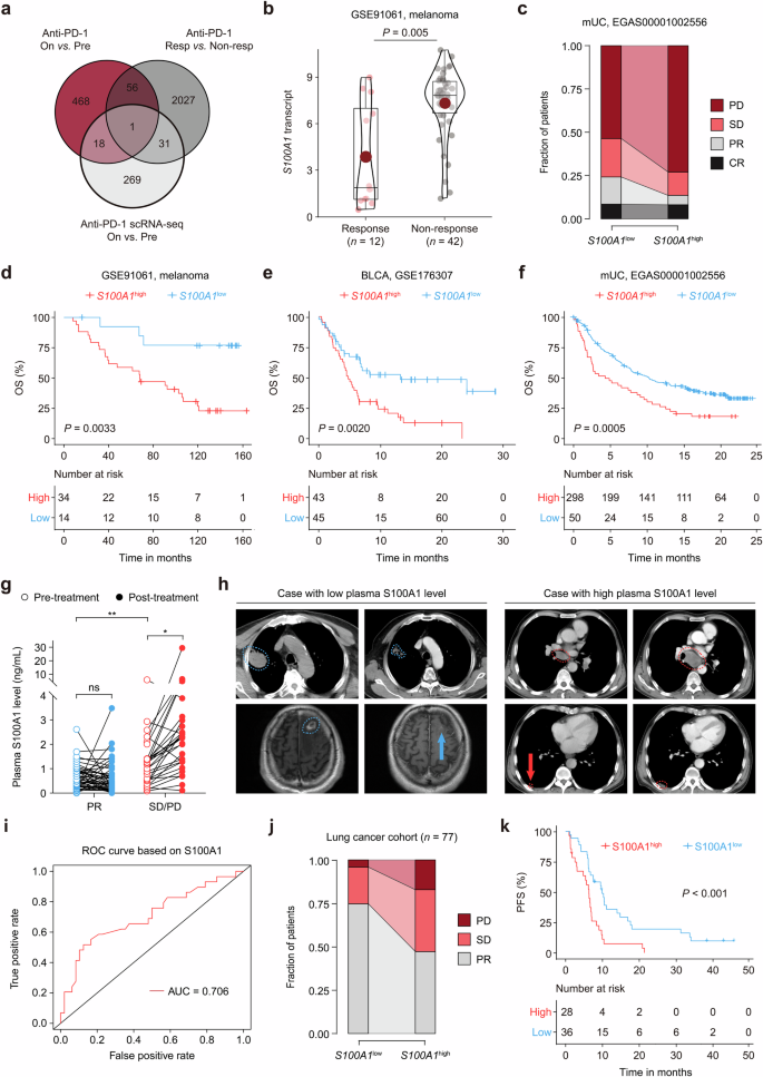 Targeting tumor-intrinsic S100 calcium-binding protein A1 augments antitumor immunity and potentiates immunotherapy efficacy