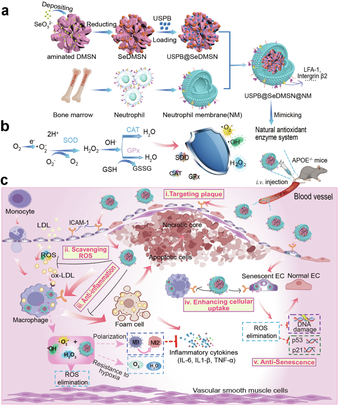 Nature-inspired confined cascade enzyme nanoreactors for targeted atherosclerosis therapy | Signal Transduction and Targeted Therapy Nature-inspired confined cascade enzyme nanoreactors for targeted atherosclerosis therapy | Signal Transduction and Targeted Therapy