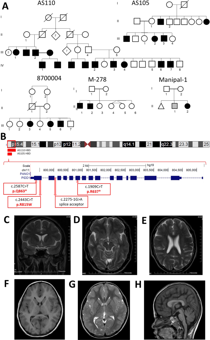Biallelic Mutations In The Death Domain Of Pidd1 Impair Caspase 2 Activation And Are Associated With Intellectual Disability Translational Psychiatry