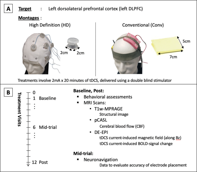 dorsolateral prefrontal cortex tdcs