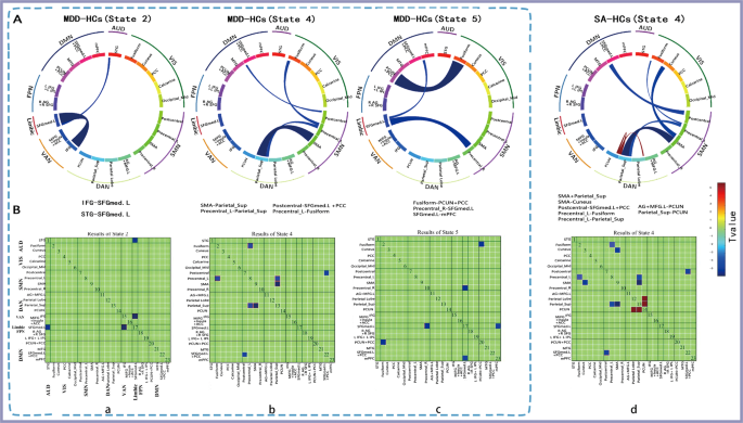 Fig. 3: Functional network connectivity differences between patients with major depressive disorder (MDD) and HCs in state 2, state 4, and state 5 and between SAs and HCs in state 4.