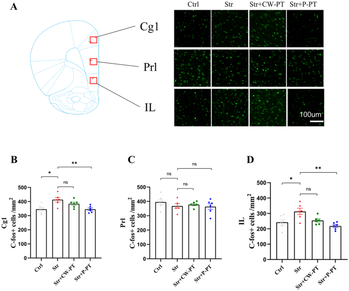 Fig. 5: The effect of phototherapy on c-fos expression in Cg1, Prl and IL.