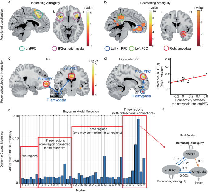 Fig. 2: Psychophysiological interaction (PPI) and dynamic causal modeling (DCM).